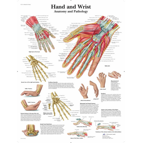 Hand & Wrist Wall Chart