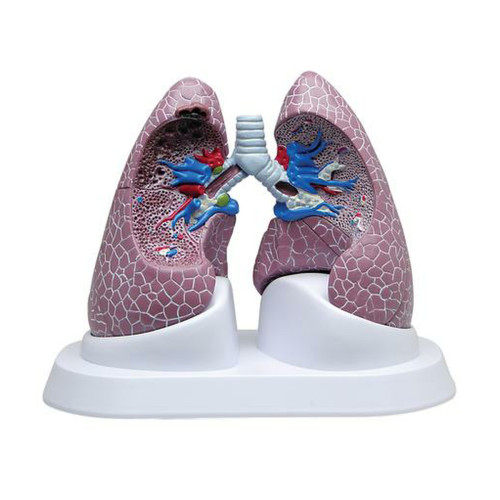 3B Lung Set with Pathologies